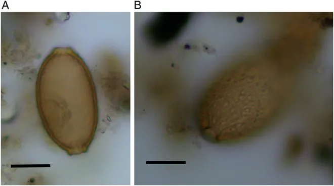 Fóssil de capilarideo encontrado nos coprólitos: a barra indica medida de 20 micrômetros (Imagem: Mitchell et al/Parasitology)