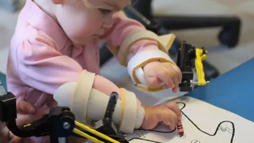 Menina de 4 anos ganha novos 'braços' feitos em impressora 3D