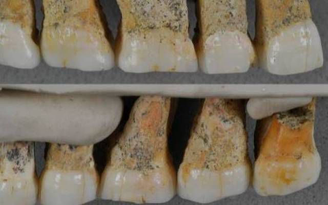 Dentes do Homo luzonensis