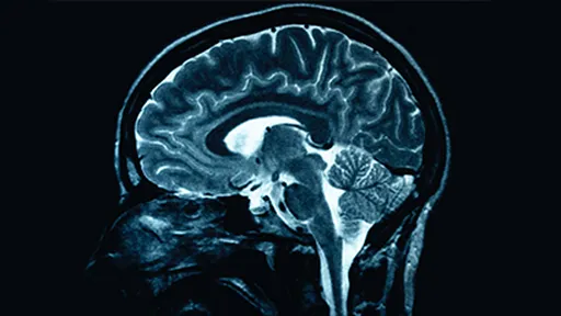 Scanner cerebral determina a idade do paciente