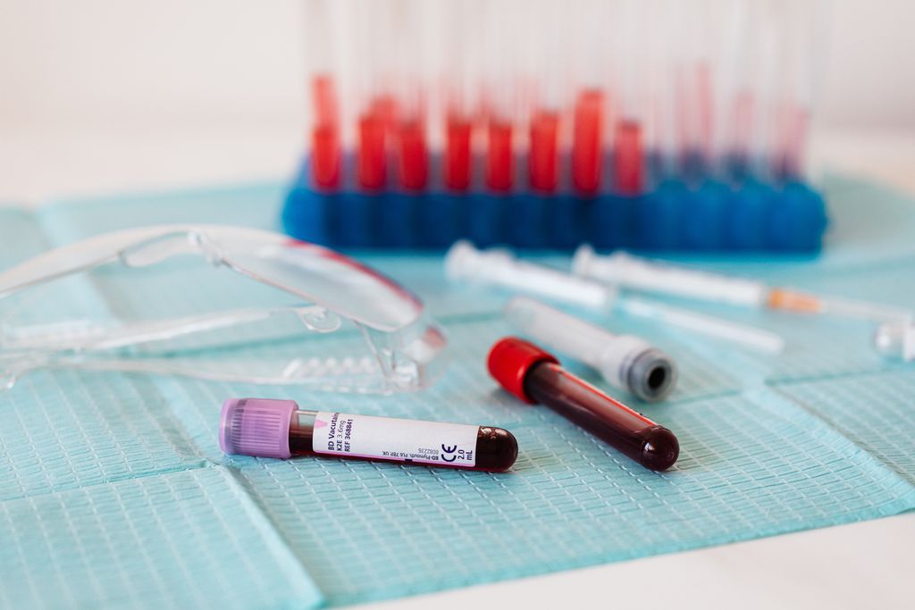 Exames para identificar infecções para o novo coronavírus testam a presença de determinados anticorpos no sangue dos pacientes (Imagem: reprodução/ Pexels)