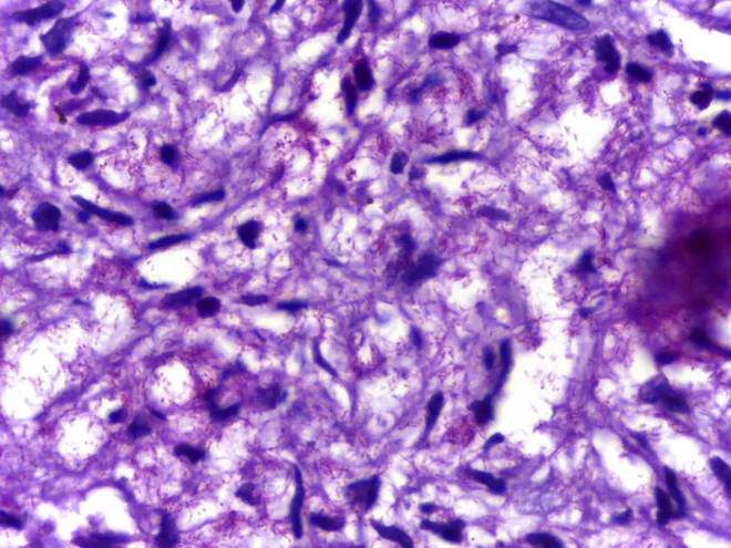 Visão microscópica da Mycobacterium leprae, causadora da hanseníase — condição tem tratamento e cura (Imagem: Wikimedia Commons)