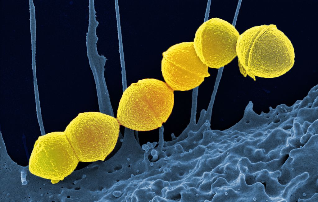 Causadora da sndrome do choque txico estreptoccico, bactria potencialmente mortal se prolifera no Japo (Imagem: NIAID/CC-BY-2.0)