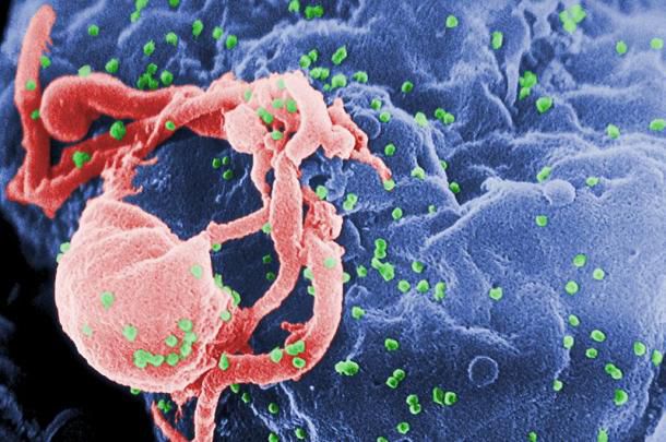 Representação clínica do vírus HIV, com a infecção ativa: pesquisa feita por especialistas no Reino Unido promete anular fatores de transmissão por meio de medicamentos retrovirais
