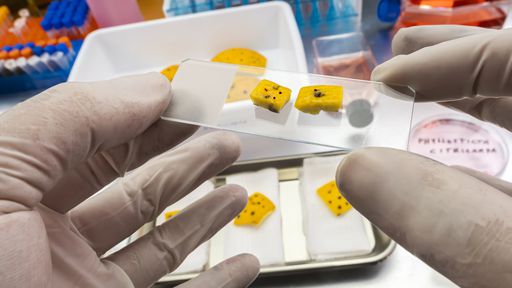 Anvisa faz alerta sobre prevenção de infecções fúngicas