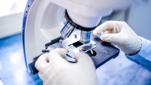 Cientistas desenvolvem lâmina de microscópio inteligente que detecta câncer