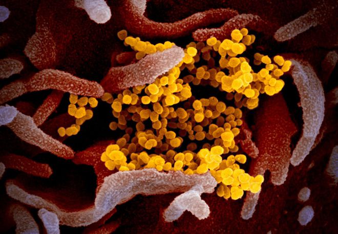 Mutação do novo coronavírus entre humanos é baixa, afirmam cientistas