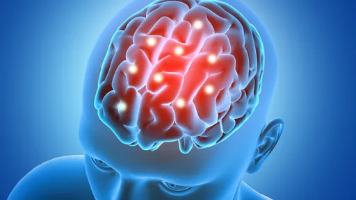 Tecnologia permite a entrega de remédios no cérebro de pacientes com Alzheimer