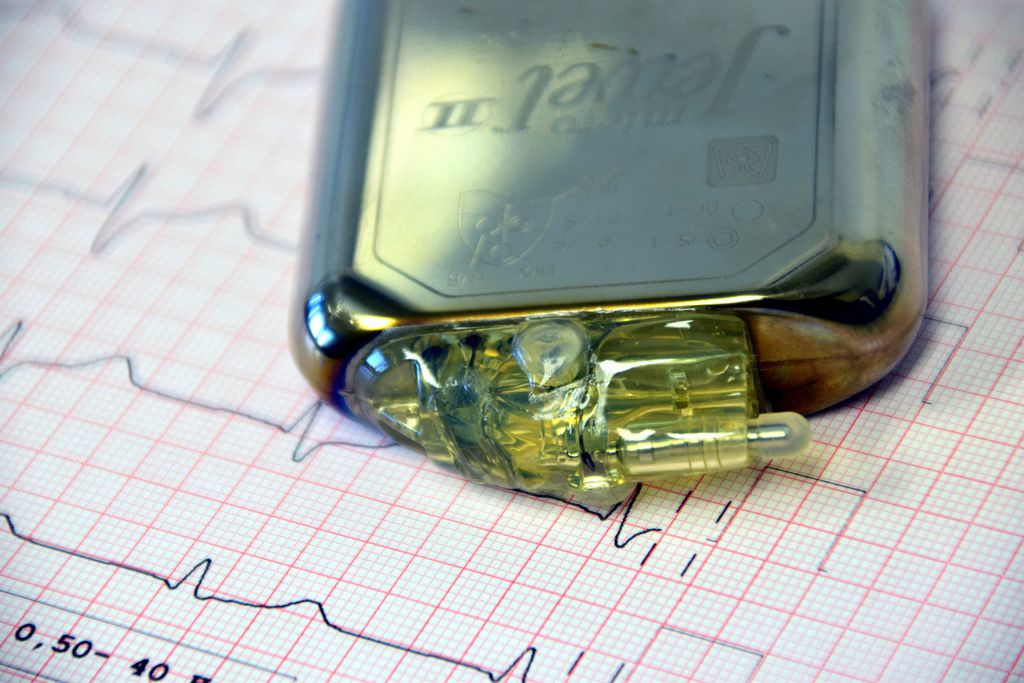 O marca-passo é um famoso aparato tecnológico utilizado pela cardiologia para um cuidado prático dos pacientes com problemas cardíacos (Imagem: Ulrike Leone/Pixabay)