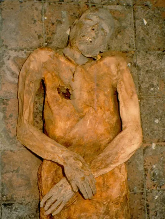 Múmia de Giovani d'Avalos, nobre napolitano cuja inflamação na vesícula biliar foi resultado de uma infecção por E. coli (Imagem: Universidade de Pisa/Divulgação)