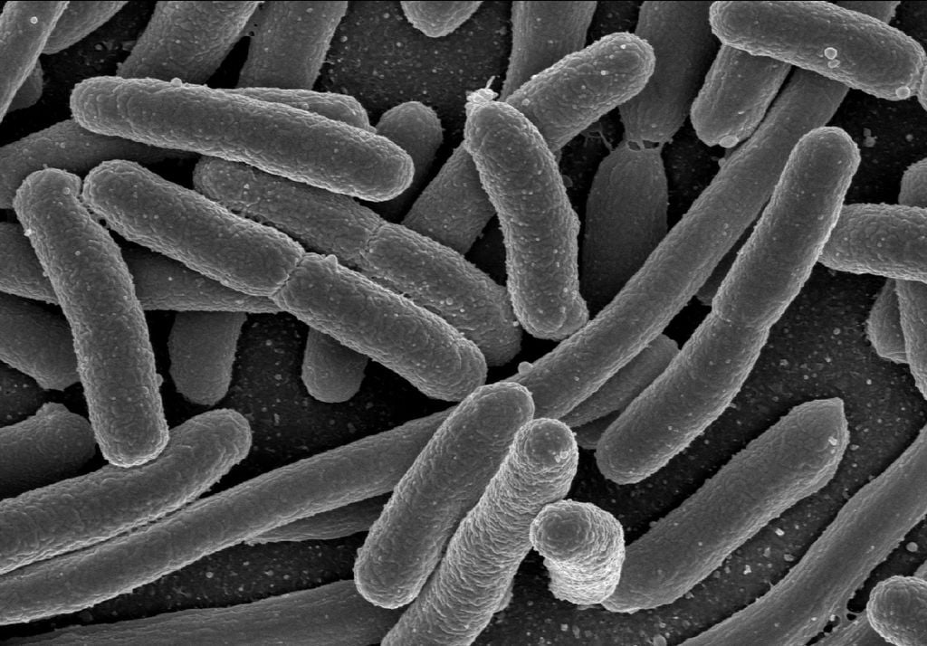 Contaminao por bactria E. Coli pode ser fatal (Imagem: NIAID/Wikimedia Commons)