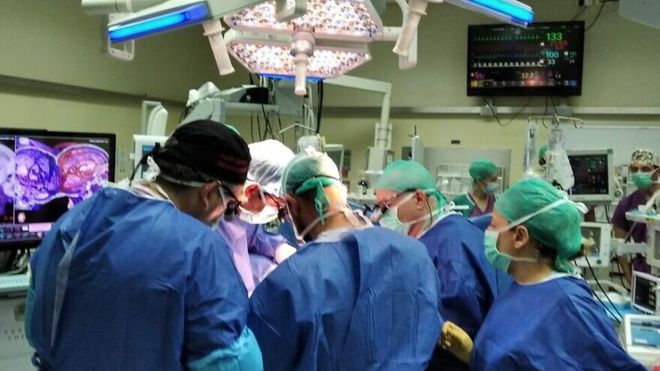Cirurgia levou 12 horas e envolveu meses de preparação (Divulgação/Soroka Medical Center)