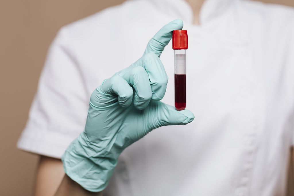 Pessoas com sangue tipo A são 2,5x mais propensas a desenvolver COVID grave