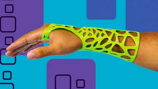 Impressão 3D: a próxima fronteira da saúde