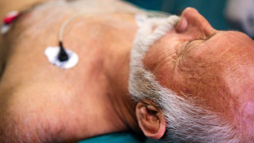 Eletrocardiograma com IA pode ser o exame do futuro no diagnóstico da COVID