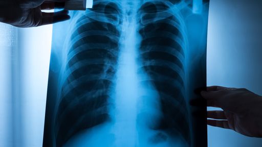 Este homem criou sua própria máquina de raio X após susto com conta de hospital