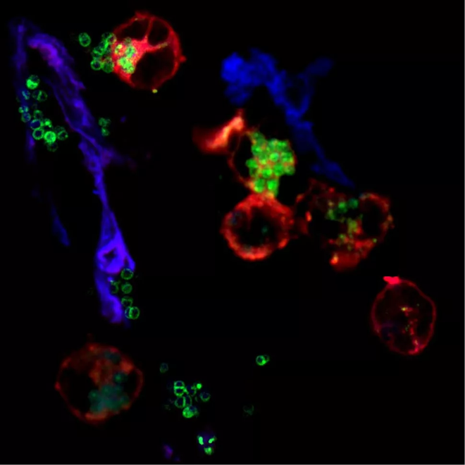 Neutrófilos (em vermelho) usam NETs (em azul) para capturar bactérias (em verde) (Imagem: Andrew J. Monteith/Vanderbilt University)