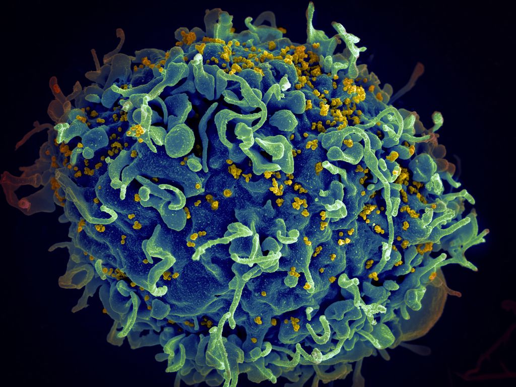 Injeção semestral do remédio lenacapavir impede infecção pelo HIV em mulheres (Imagem: National Cancer Institute/Unsplash)