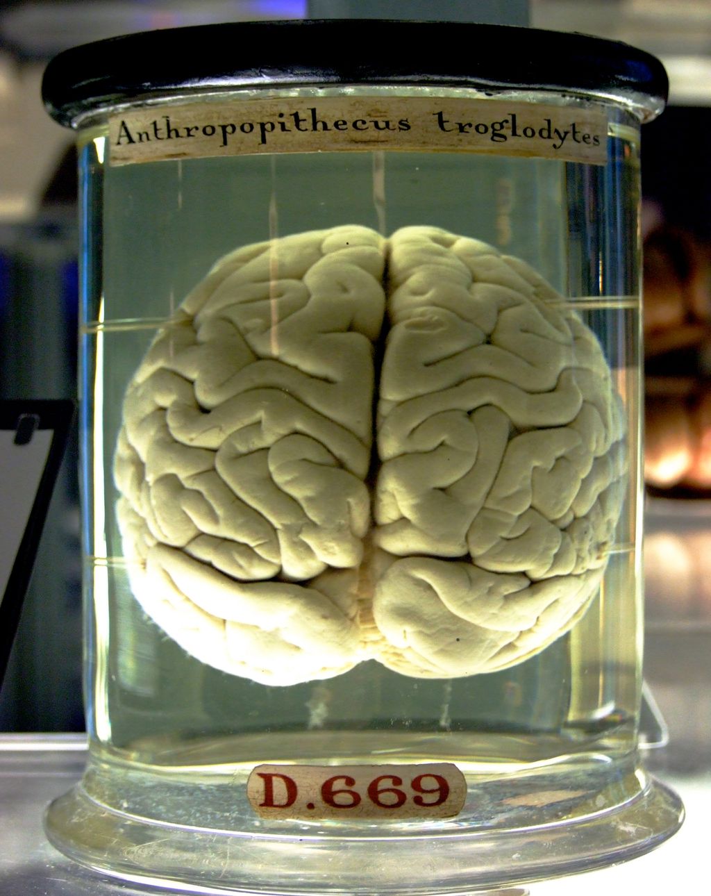 Um cérebro em uma cuba não acredita que está em uma cuba (Imagem: Reprodução/Gaetan Lee)