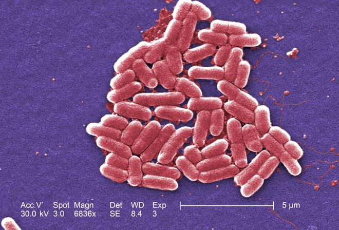 Nova classe de antibióticos vai combater as superbactérias, como a