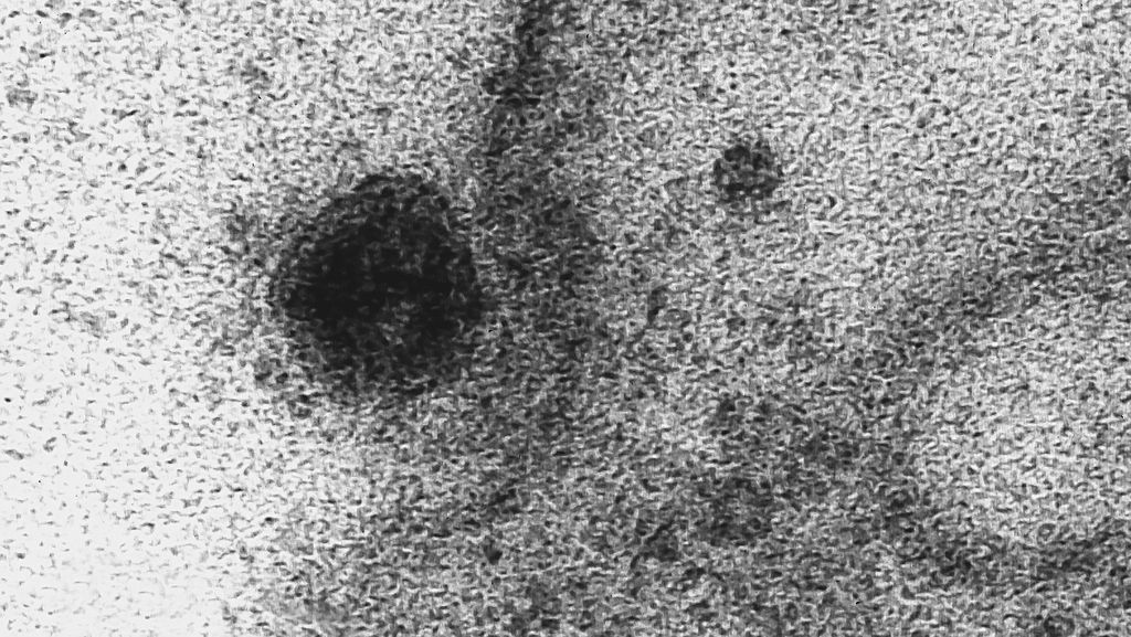 Ação de coronavírus (círculo escuro) é registrada em células saudável por cientistas (Imagem: Débora F. Barreto-Vieira/IOC/Fiocruz)