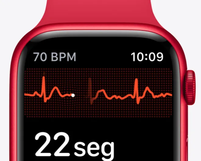 Além dos batimentos cardíacos, ECG também detecta possíveis problemas do coração (Imagem: Divulgação/Apple)