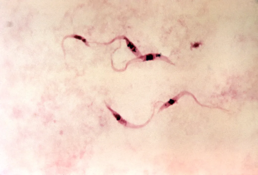 Imagem de microscópio do Trypanosoma cruzi, protozoário causador da doença de Chagas (Imagem: CDC/Myron G. Schultz)