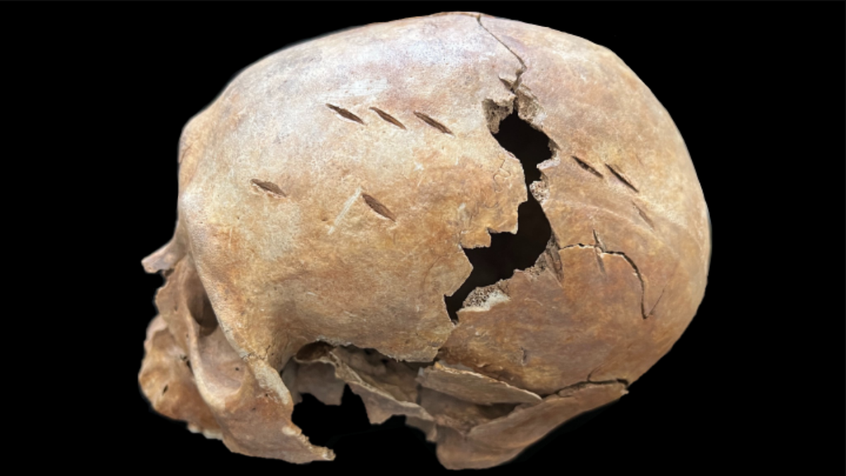 18 facadas em crânio de 3.700 anos revelam mortes violentas na China antiga
