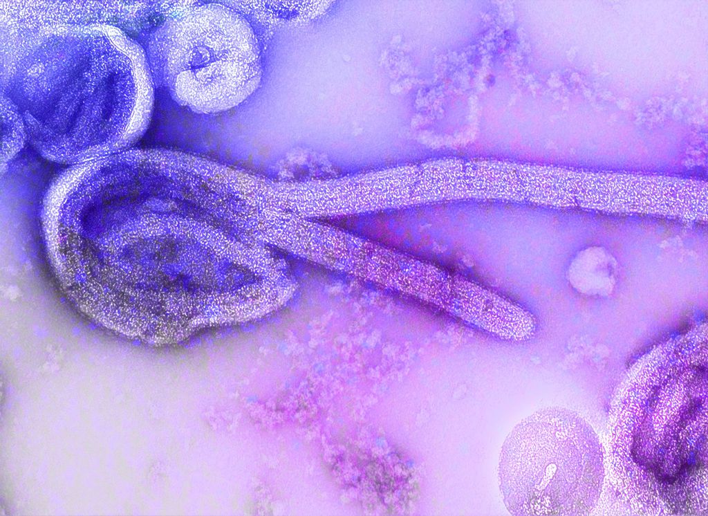 O vírus Chapare causa sintomas muito semelhantes ao Ebola (Imagem: CDC/Unsplash)
