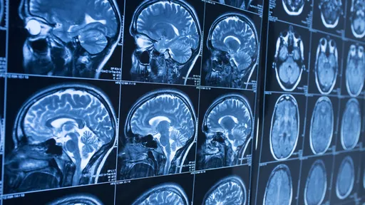 Neurocientista encontra região do cérebro humano antes desconhecida