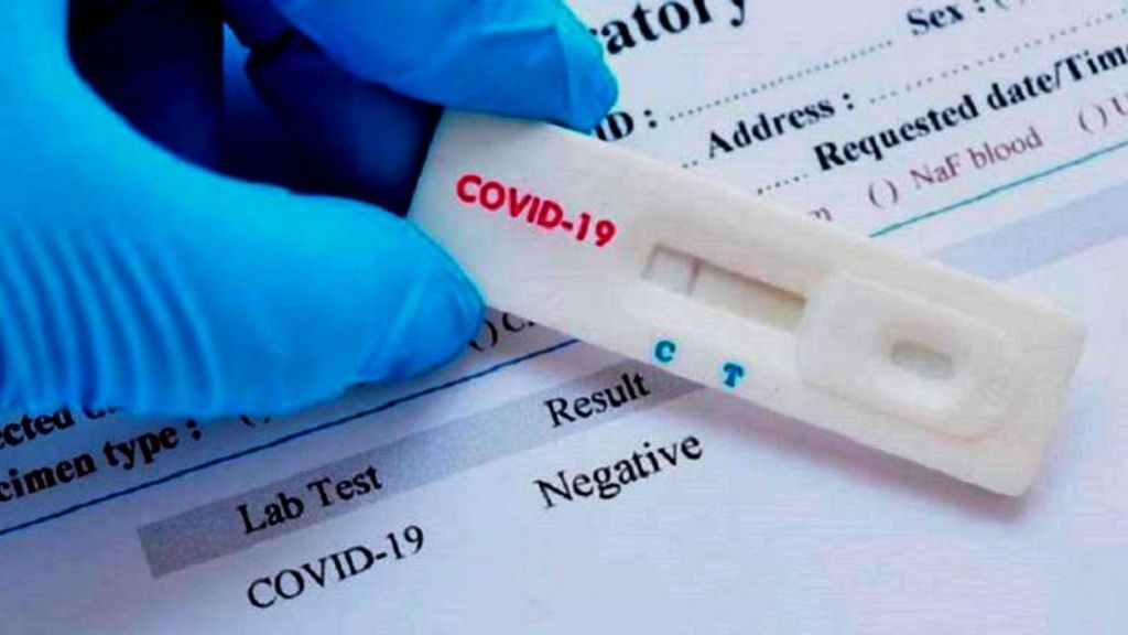 Planos de saúde são obrigados a cobrir testes para o novo coronavírus (Imagem: reprodução/ iStock) 