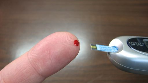Risco de amputação por diabetes estaria ligado a localidade e etnia, diz estudo