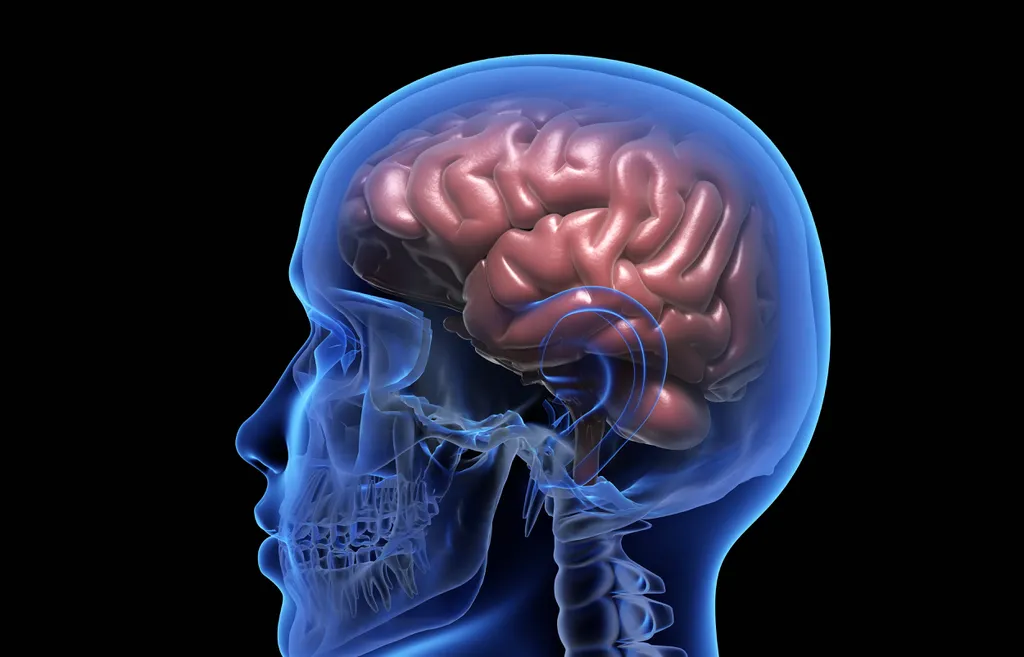 Hemorragia pode acontecer dentro do crânio ou no próprio tecido cerebral (Imagem: Reprodução/iLexx/Envato)