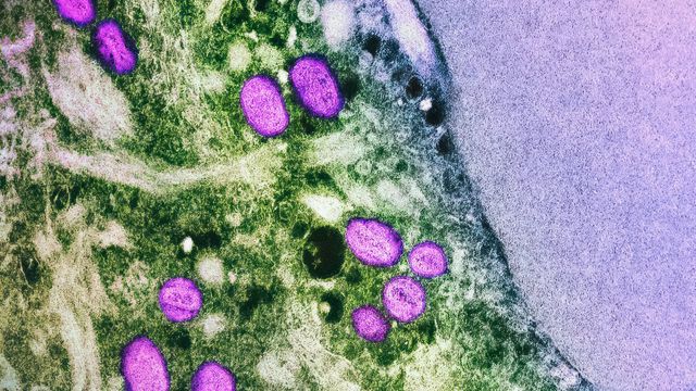 National Institute of Allergy and Infectious Diseases