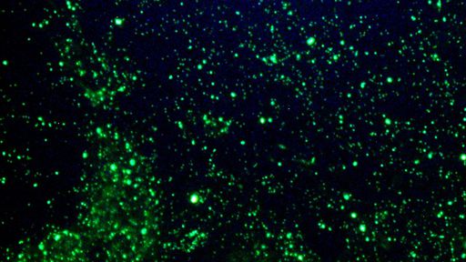 Com amostra de saliva, novo exame revela presença de coronavírus em 15 minutos