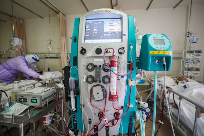Tecnologia oxigena o sangue fora do corpo para ajudar vítimas da COVID-19