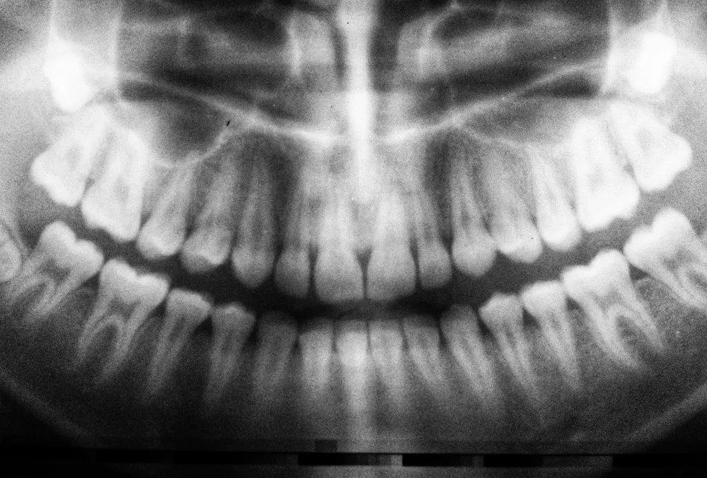 Ao contrário do que muitos pensam, os dentes não são ossos (Imagem: Umanoide/Unsplash)