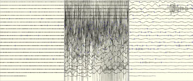 A Escala Richter e a sua versão mais moderna, a Escala de Magnitude de Momento, usam dados de sismógrafos para calcular a magnitude dos abalos sísmicos (Imagem: uair01/CC BY 2.0.)