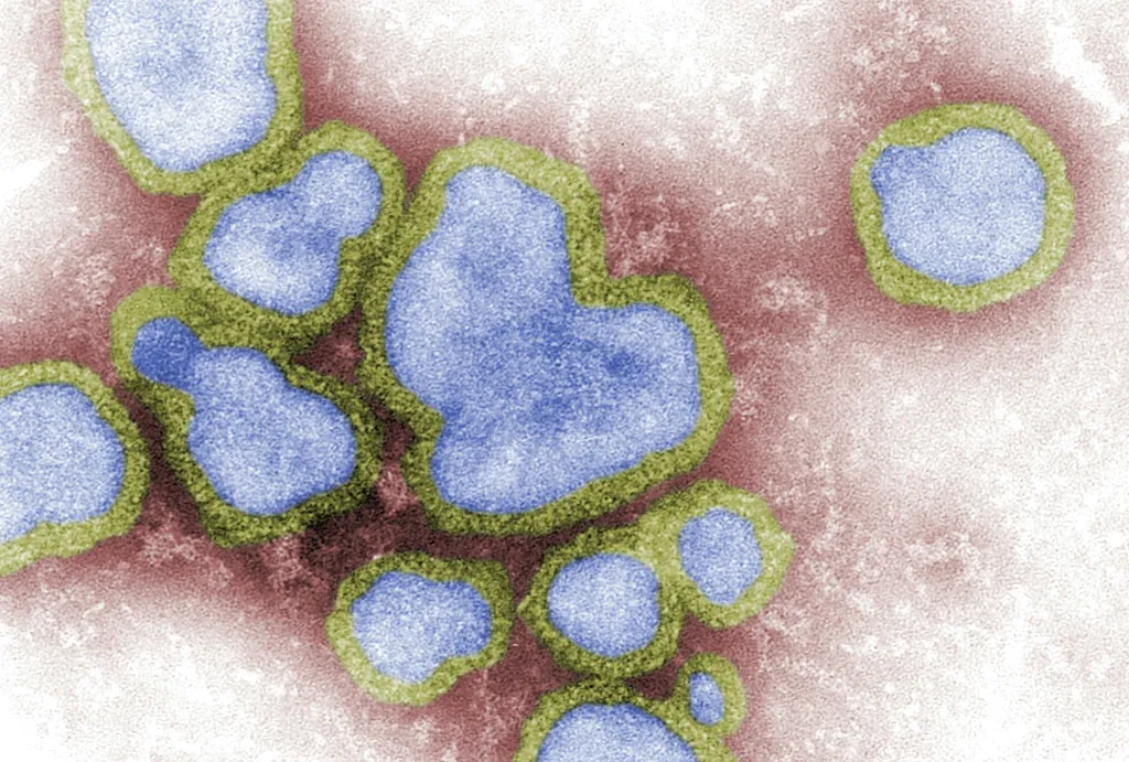 H1N1 pode descender de vírus que gerou a pandemia de gripe em 1918, segundo estudo (Imagem: CDC/Unsplash)