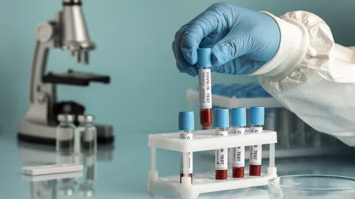 Testes de covid: saiba a diferença entre exames PCR e de anticorpos
