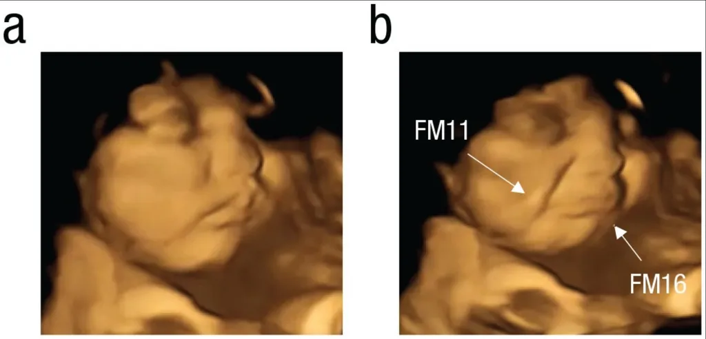 Sim, esse é o ultrassom 4D de um bebê fazendo cara feia para a couve que sua mãe ingeriu! (Imagem: Ustun/Durham University)