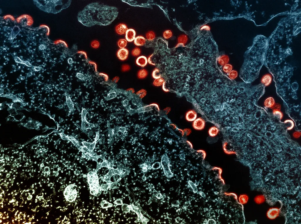 Já se suspeitava que o HIV pudesse ficar nas micróglias, reservatórios do sistema imune no cérebro, mas o estudo confirmou a possibilidade (Imagem: NIAID/CC-BY-2.0)