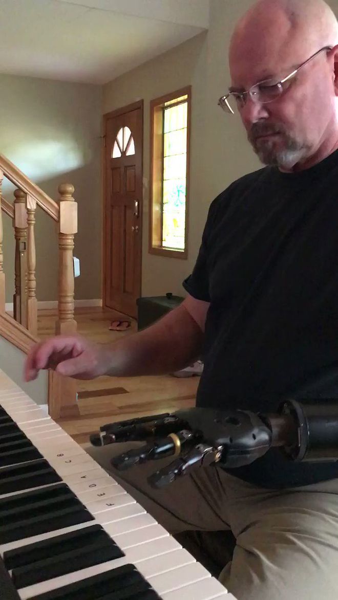 Homem com braço robótico controlado pela mente está aprendendo a tocar piano