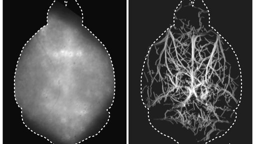 Sem cirurgia: nova técnica microscópica consegue observar a atividade cerebral