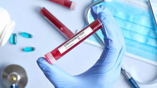 Testes de COVID-19 na Islândia mostram que metade dos infectados é assintomática