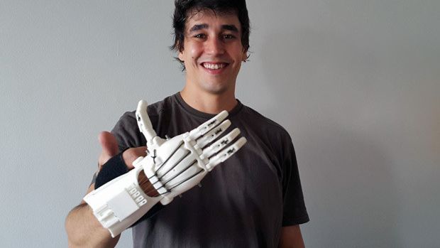 Brasileiro faz próteses em impressora 3D para ajudar crianças amputadas