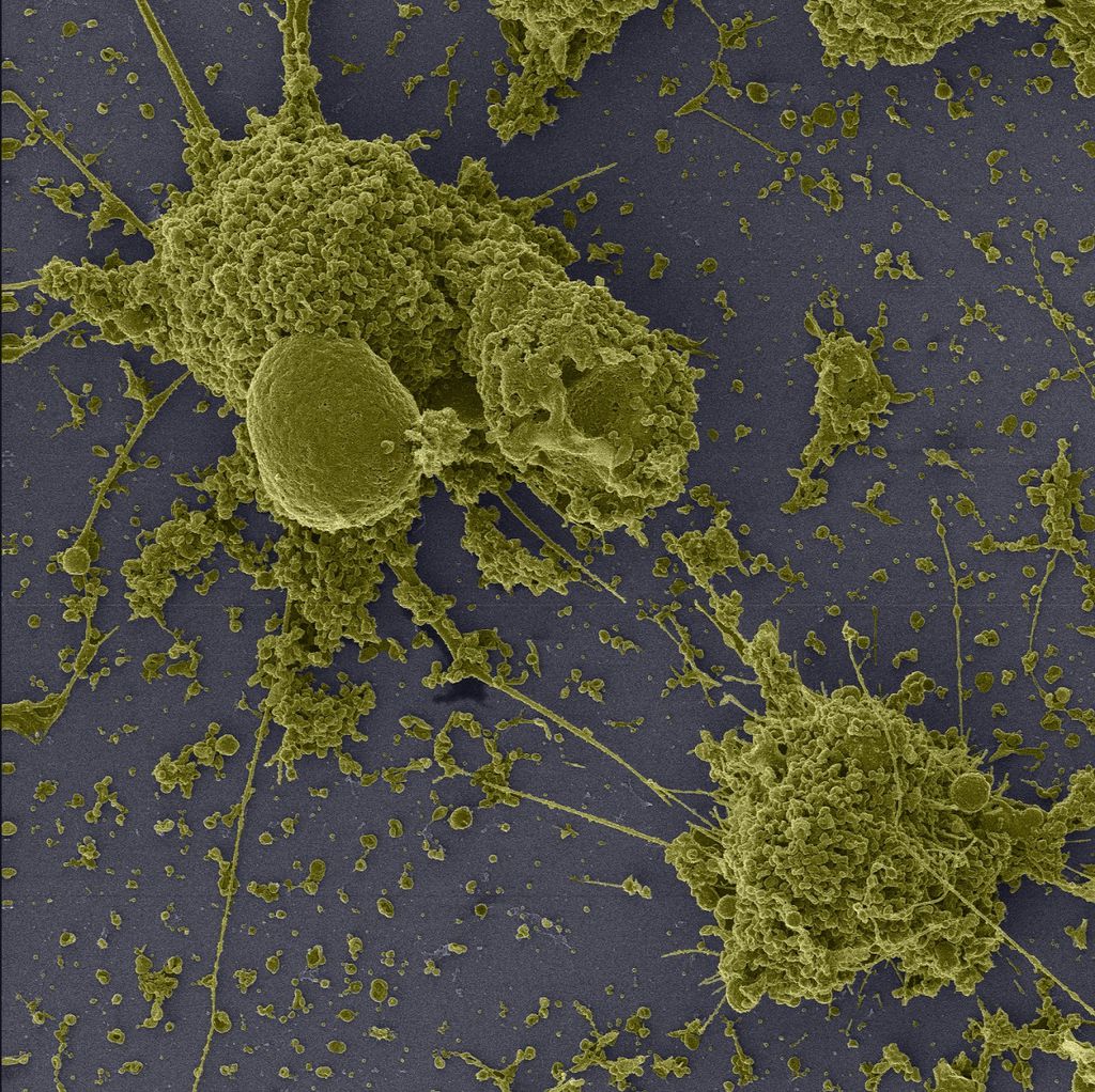 Pesquisadores dão mega zoom em células infectadas spelo coronavírus  (Imagem: Reprodução/ LMMV/IOC/Fiocruz, LVRS/IOC/Fiocruz e Nulam/Inmetro)