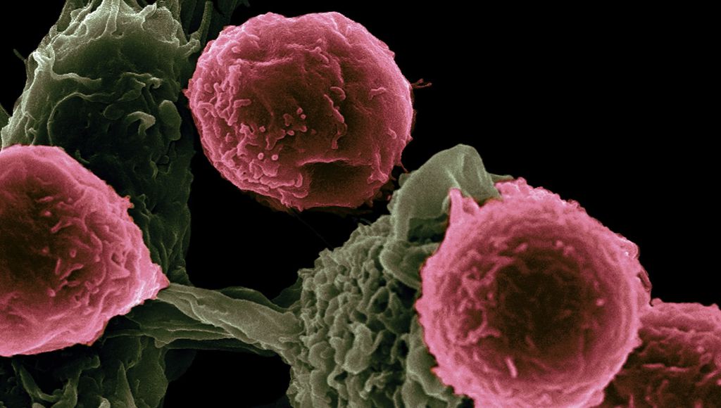 Tipo específico de colágeno pode ser a resposta para manter as células do câncer dormentes (Imagem: Reprodução/National Cancer Institute/Unsplash)