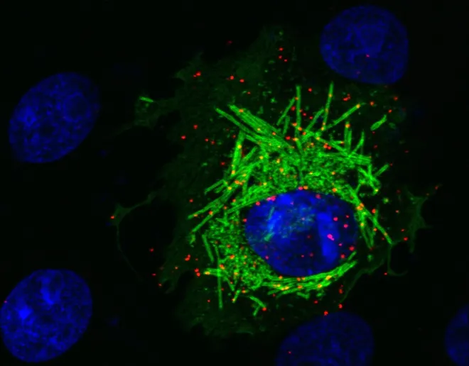 Interação da proteína celular PCNA e a proteína M do SARS-CoV-2 em ensaio: Em vermelho, a proteína humana PCNA migra do núcleo da célula (em azul) para o citoplasma na presença da proteína M (verde) (Imagem: Orlando B. Scudero/ICB-USP)