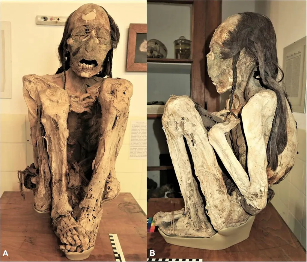 Múmia de Marburg, como é conhecida, foi encontrada no Chile e teve sua morte causada por esfaqueamento após trauma craniano (Imagem: Begerock et al./Frontiers in Medicine)